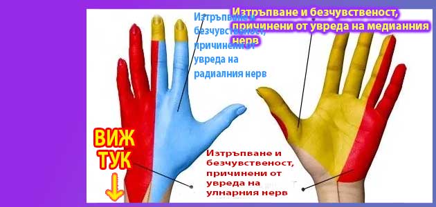 Какво се пие при изтръпване на ръцете 1