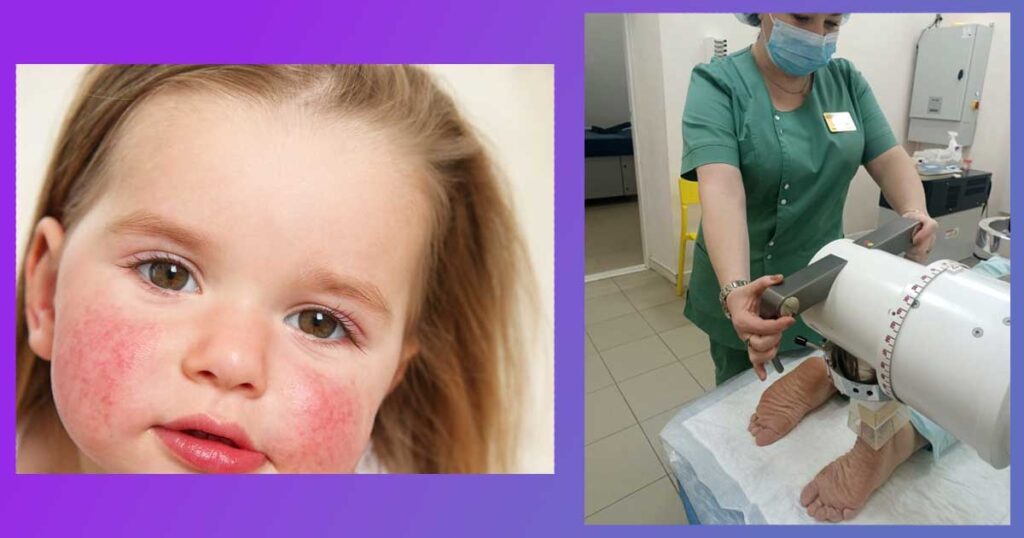 Кои са най-добрите витамини при невродермит. Стандартното лечение с мазило за невродермит, билкови хапчета и лекарства. Кислородна вода и забранени храни.