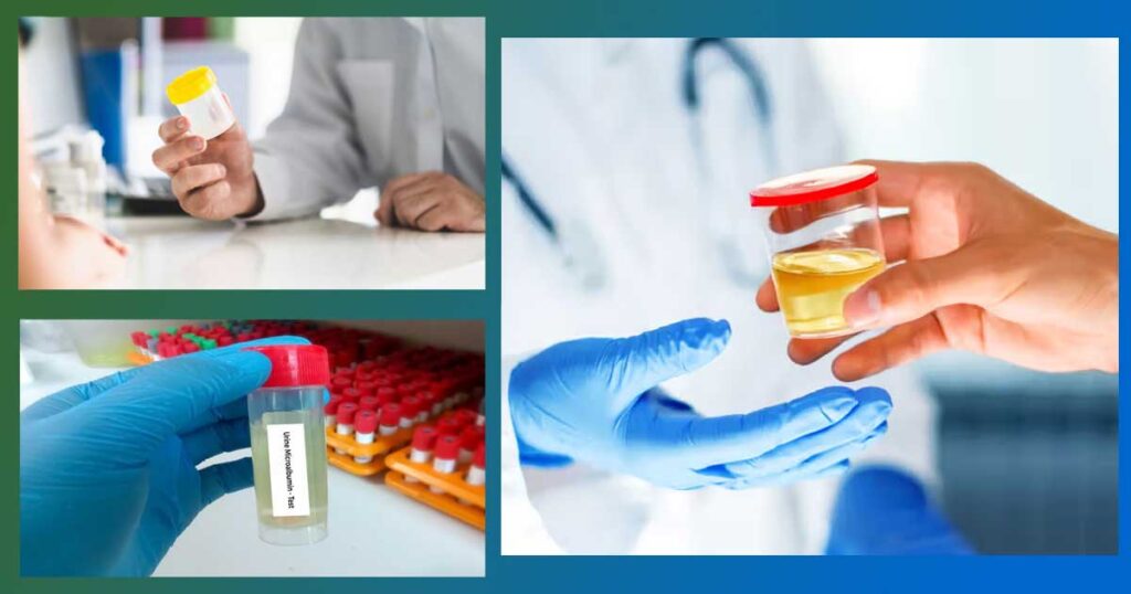 Как да понижим висок микроалбумин в урината. Референтни стойности и как се лекува микроалбуминурия. Белтък в урината и опал в урината (опалесценция) - опасен ли е при дете? Антибиотик.