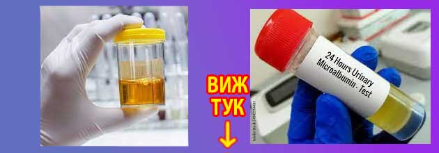Висок микроалбумин Лечение на микроалбуминурия 3