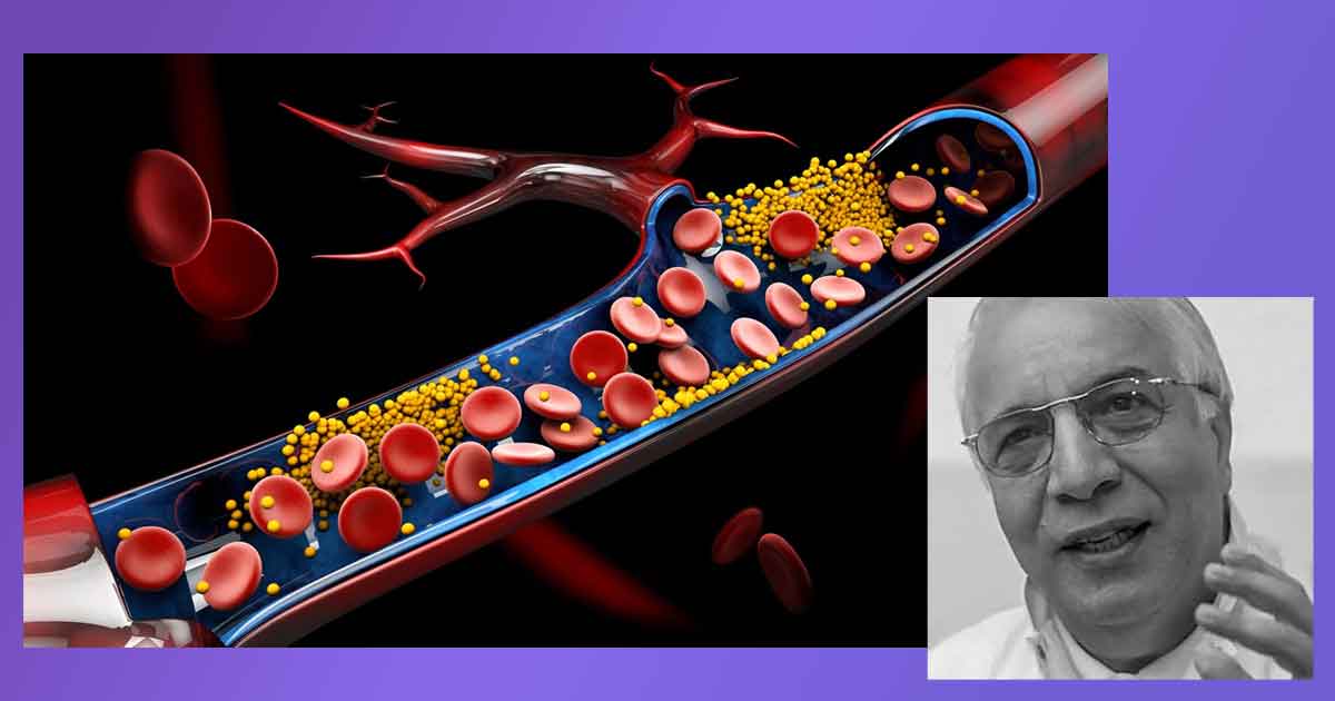 Начини за бързо почистване на кръвоносните съдове: Кой е най-мощният чистач? Стара рецепта на Чирков. Сутрин на гладно: Ленено семе с кисело мляко. Немско лекарство, чай и тинктура.