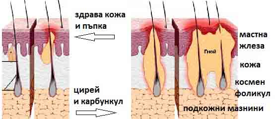 bolka mishnica-07