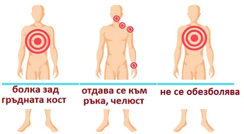 nevralgiya-05