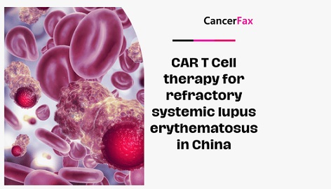 Лупус еритематозус 01