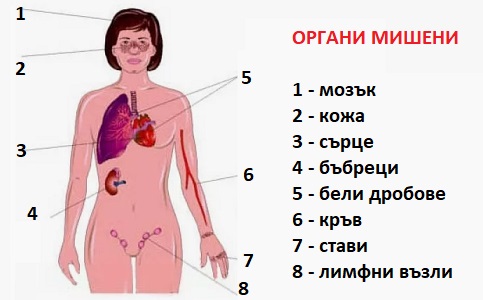 Лупус еритематозус 03